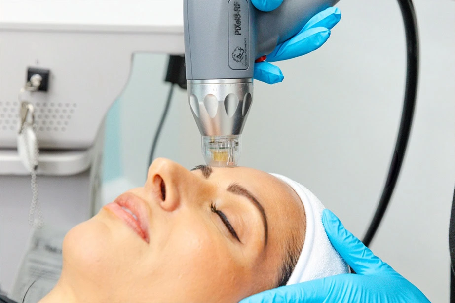 RF Microneedling in Seymour, IN | Revive Wellness Studio