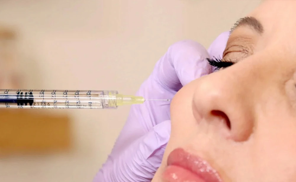Radiesse Dermal Filler in Seymour IN: Revive Wellness Studio